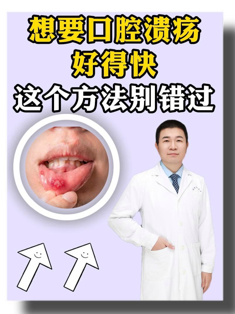 要想口腔溃疡好的快,认准这个方法 口腔溃疡 硬核健康科普行动 口疮 醋酸地塞米松口腔贴片