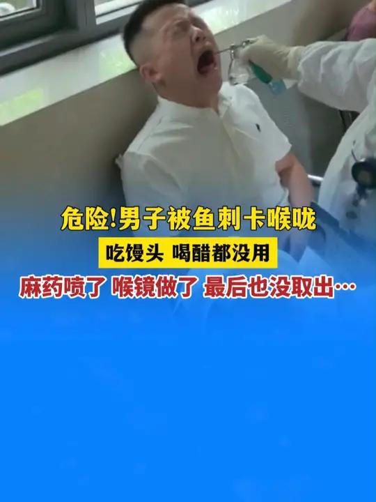 危险!男子被鱼刺卡喉咙,吃馒头,喝醋都没用,麻药喷了,喉镜做了 最后也没取出……奇闻奇事 