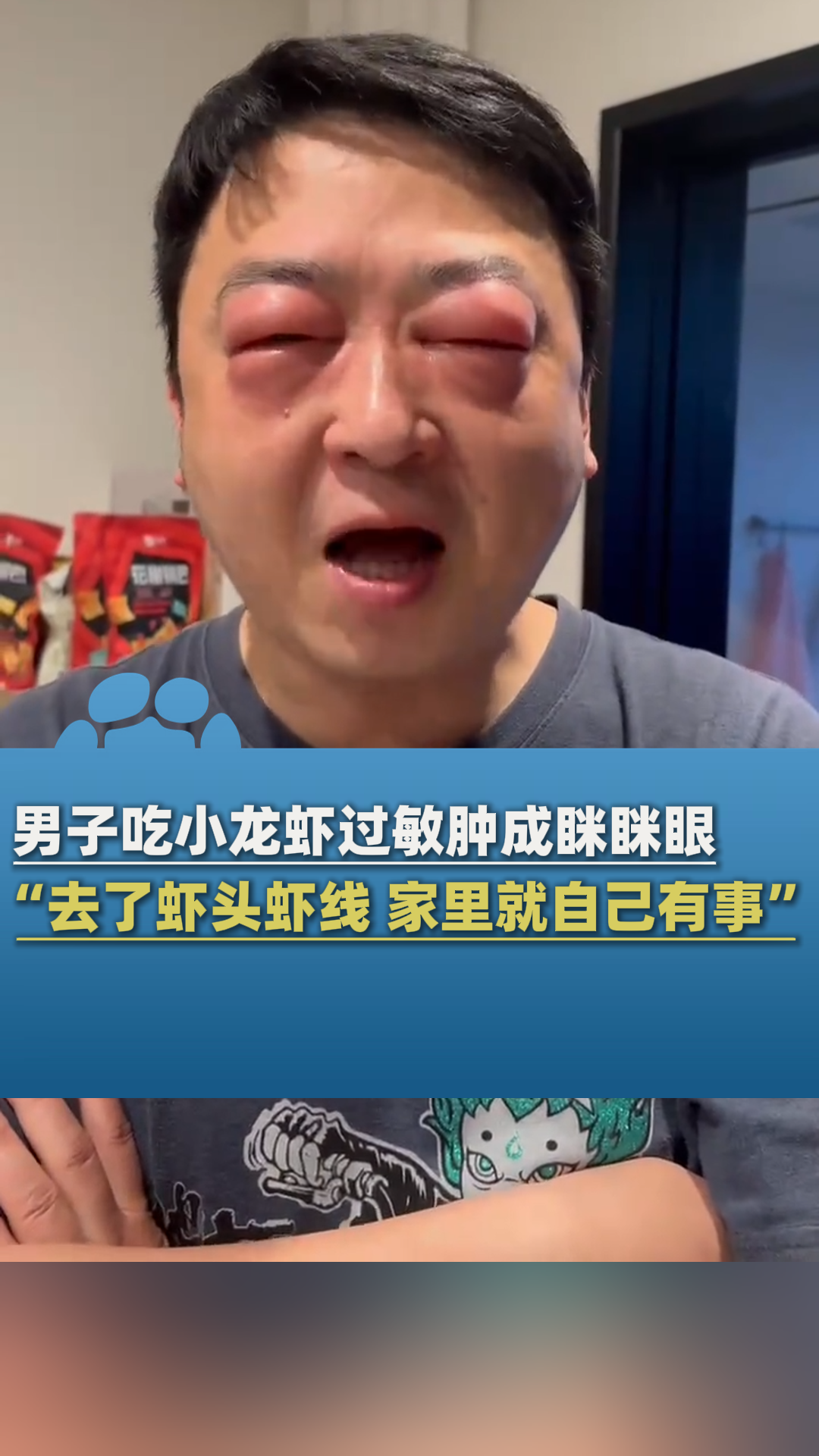 男子吃自制小龙虾过敏肿成眯眯眼,“还去了虾头虾线”