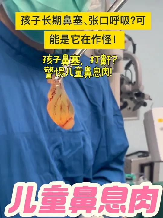孩子鼻塞、打鼾?警惕儿童鼻息肉!孩子长期鼻塞、张口呼吸?可能是它在作怪!