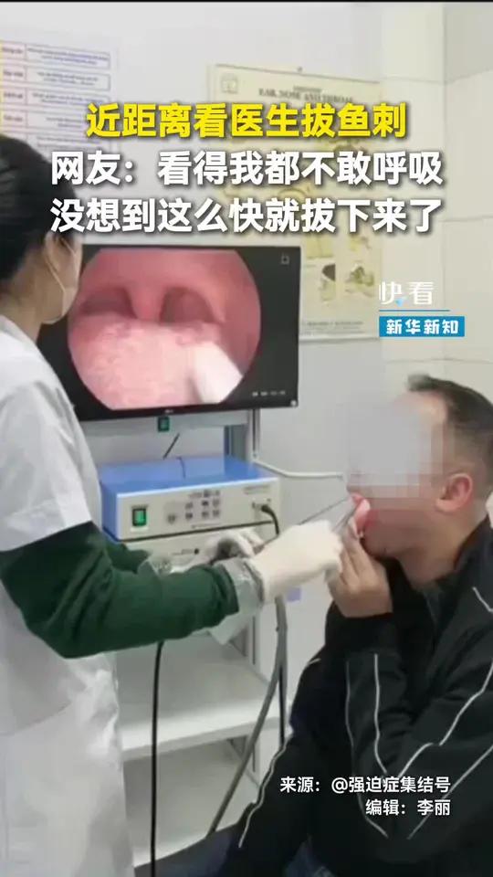 近距离看医生拔鱼刺,手太稳了!网友:看得我都不敢呼吸,没想到这么快就拔下来了