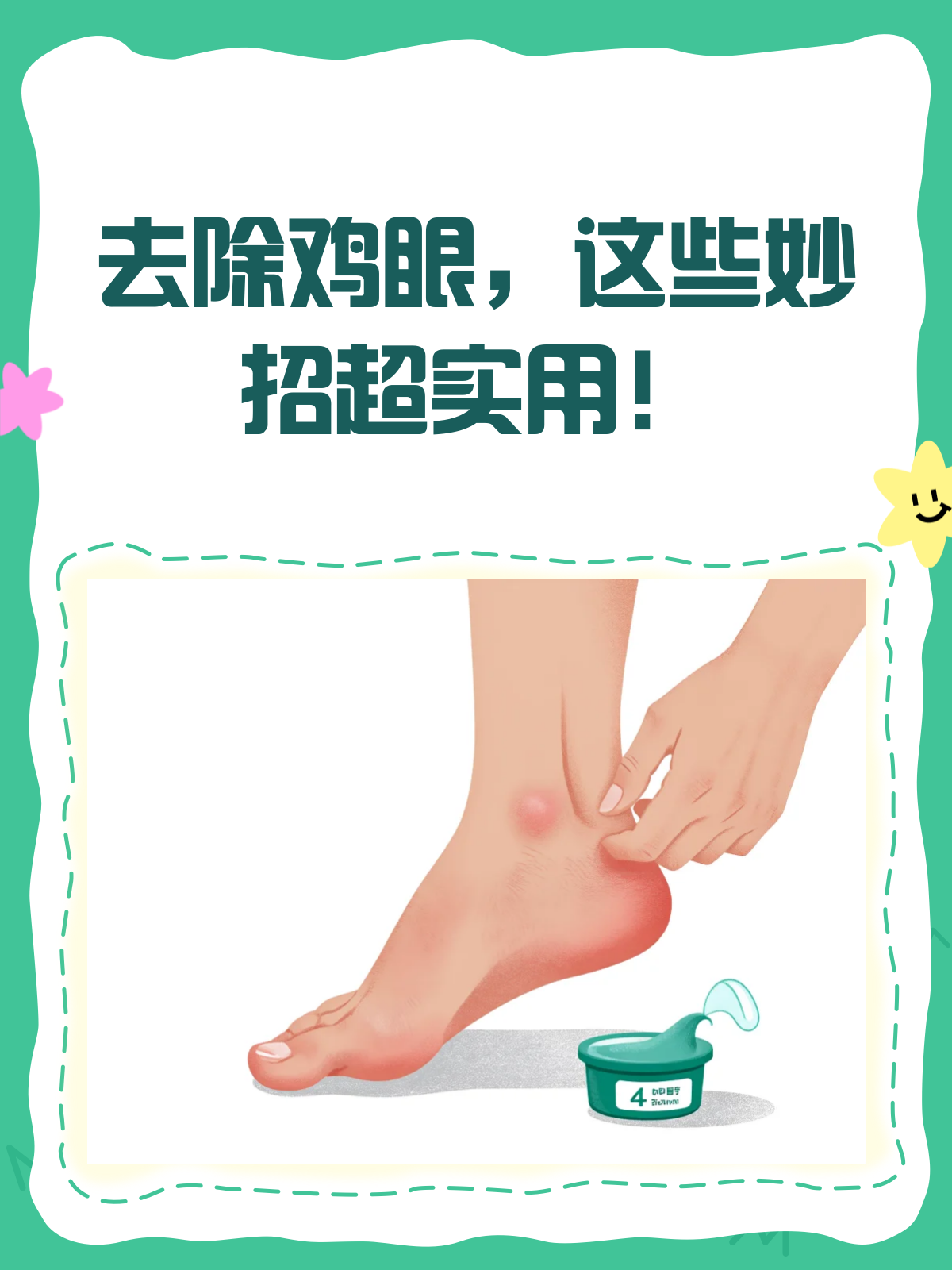 告别疼痛!去除鸡眼的小妙招来啦!