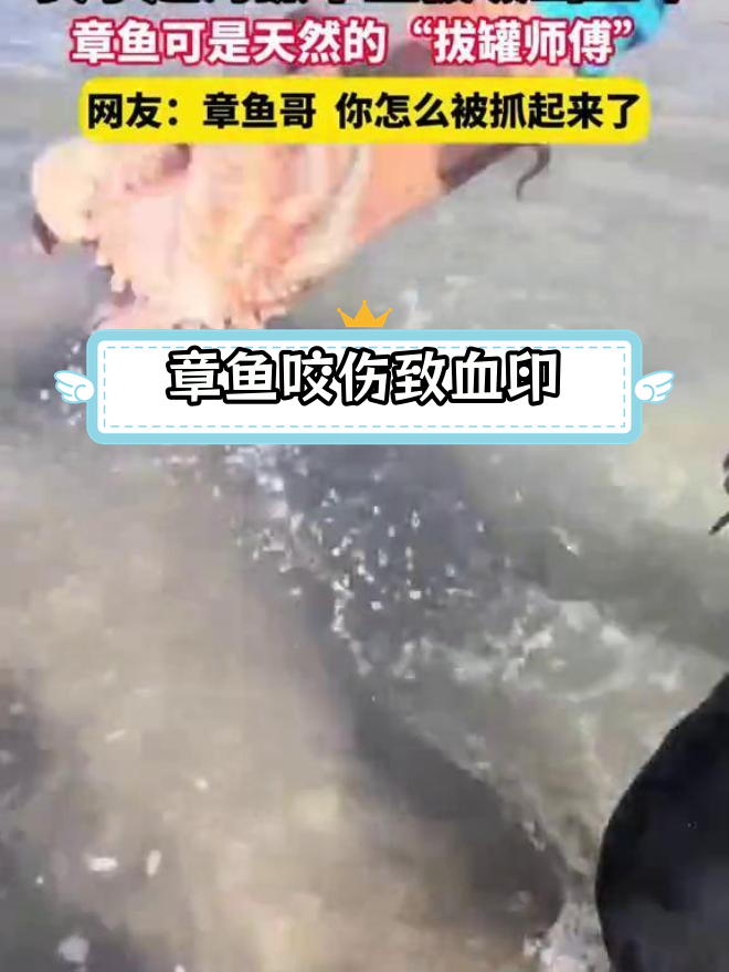 女子赶海抓章鱼,被吸出血印