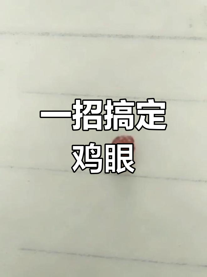 轻松拔除鸡眼,方法超简单
