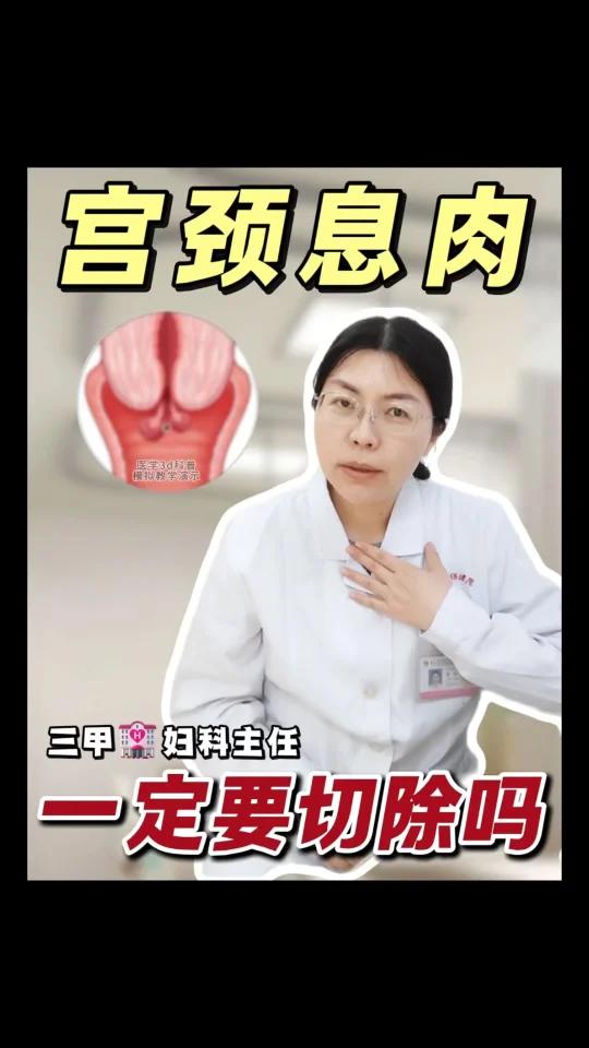 宫颈息肉必须手术摘除吗?这几点很重要!
