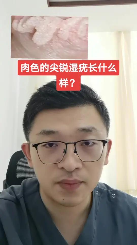 肉色的尖锐湿疣长什么样