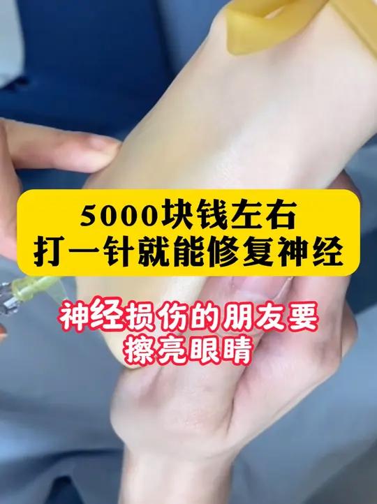 有很多朋友问我神经修复相关的问题,我也特意给大家总结了一下,有必要给大家讲一讲。首先,大家