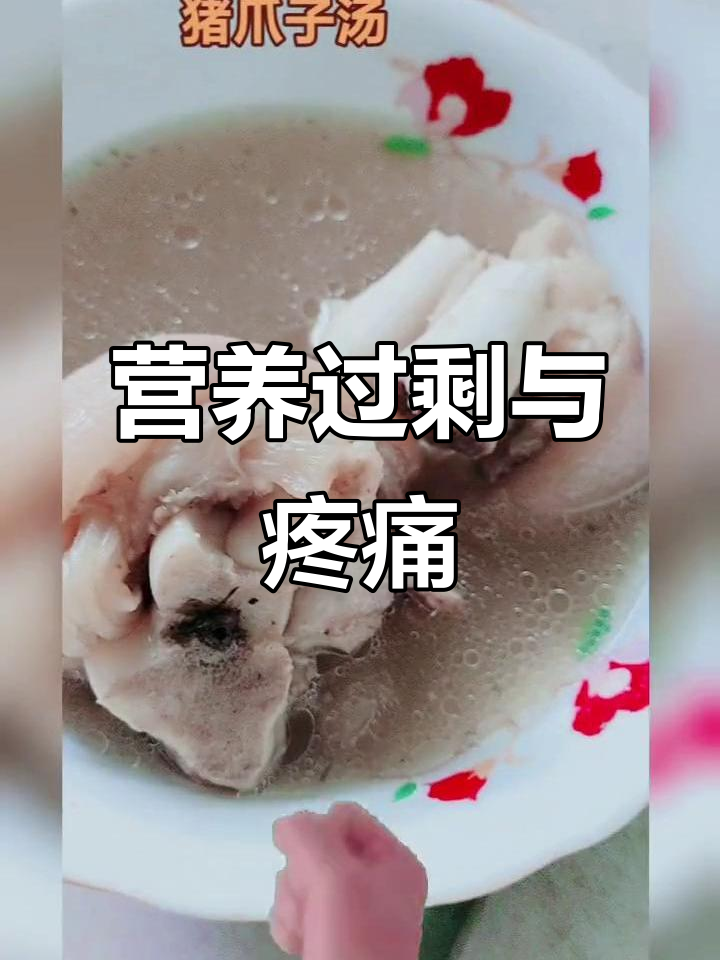 老妈拼命炖汤,我吃到撑却依旧腿疼,真是无奈啊!