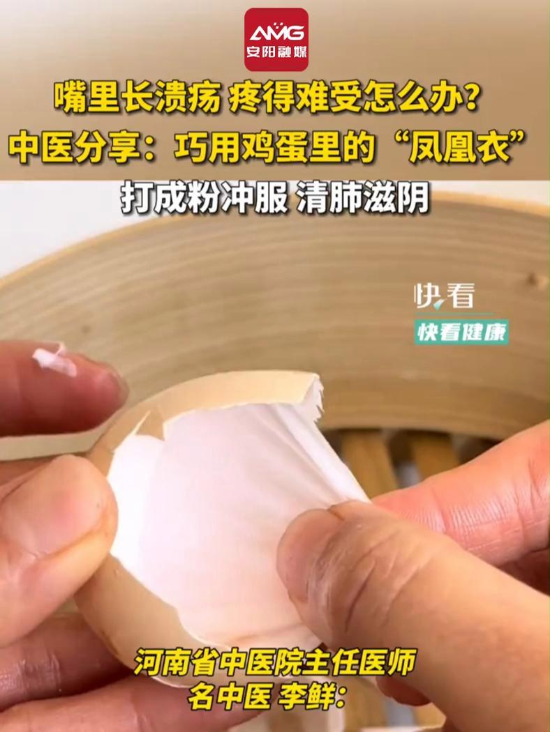 嘴里长溃疡 疼得难受怎么办?中医分享:巧用鸡蛋里的“凤凰衣”,打成粉冲服 清肺滋阴(来源: