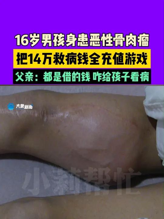 16岁男孩身患恶性骨肉瘤 把14万救病钱全充值游戏 父亲:都是借的钱 咋给孩子看病