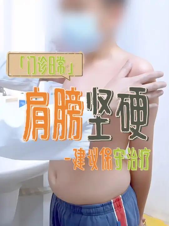 一个典型的B型鸡胸的小孩子,肩膀坚硬的情况还是建保守治疗