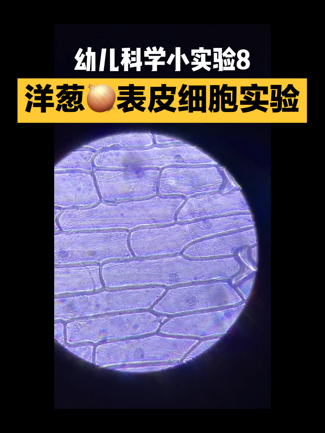 幼儿科学小实验 洋葱表皮细胞实验