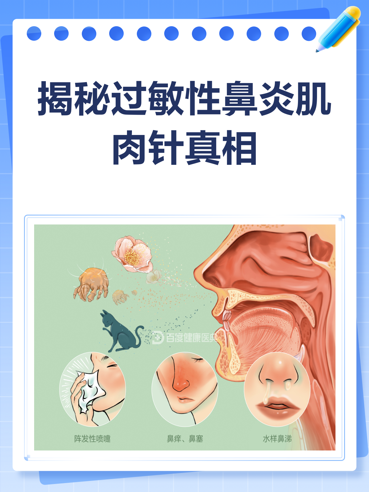 过敏性鼻炎肌肉针揭秘！你在用吗？