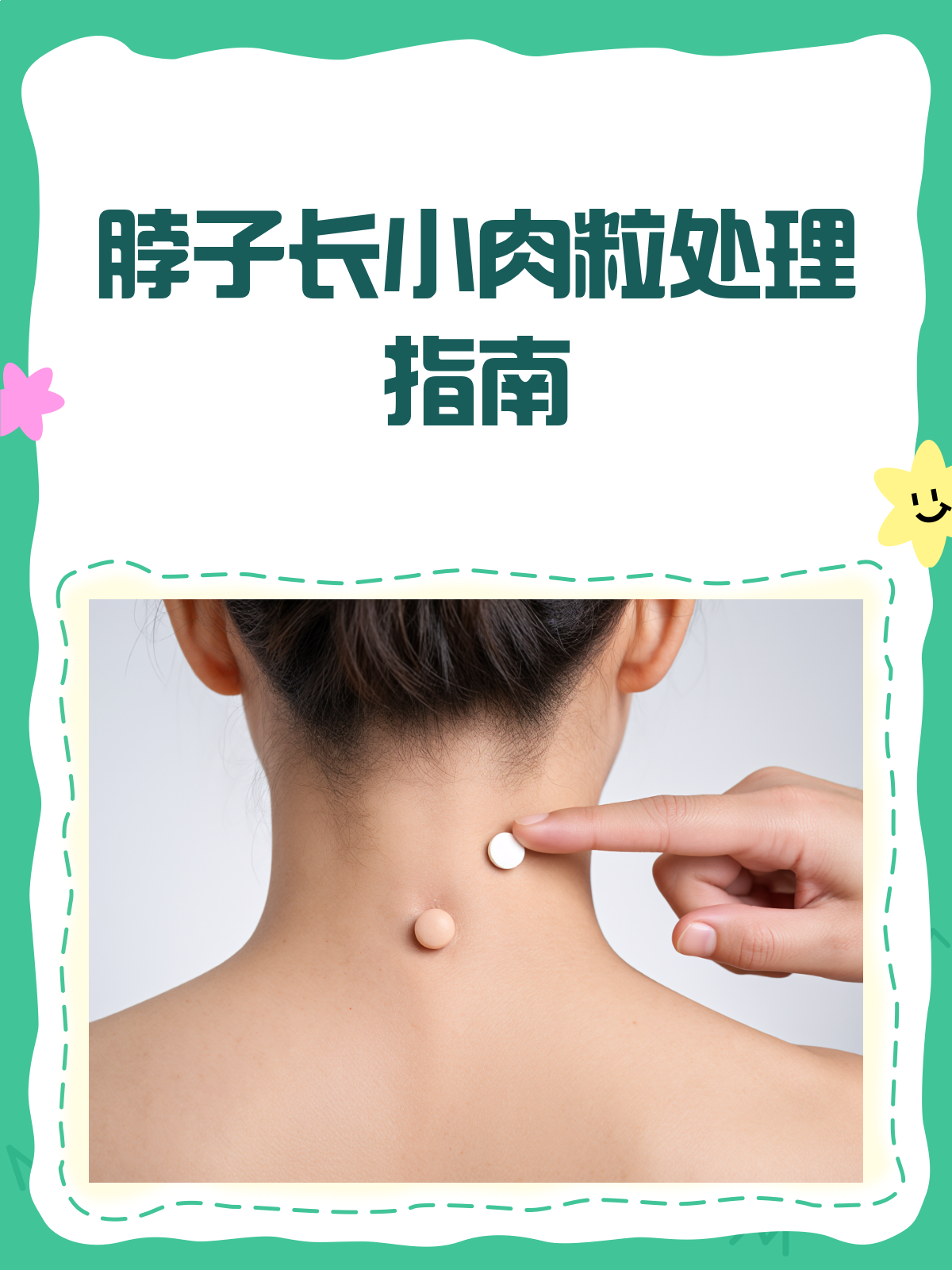 脖子长小肉粒？别急，医生教你正确处理！