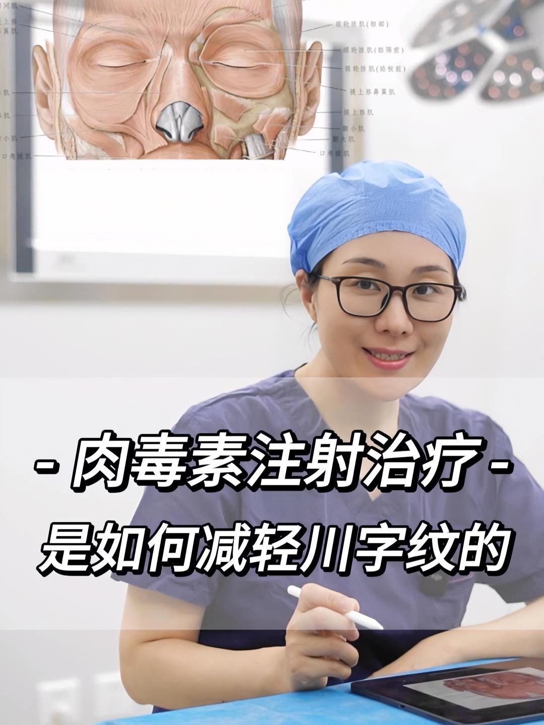 肉毒素注射治疗,是如何减轻川字纹的?医学科普 变美 川字纹 皱纹 肉毒