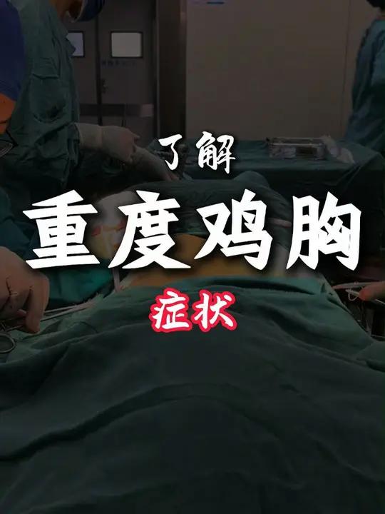 重度鸡胸,有压迫心肺的症状,不做手术会怎样?鸡胸 微创手术