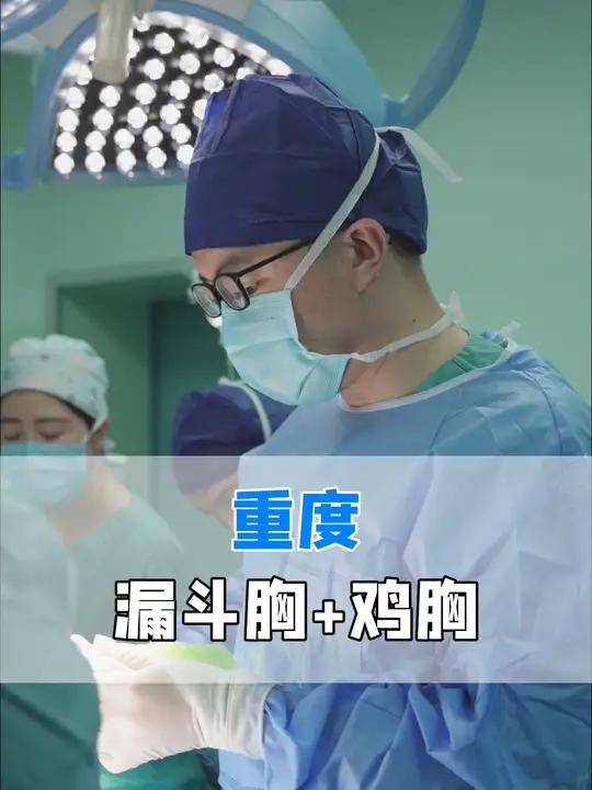 重度漏斗胸+鸡胸,不对称胸廓畸形,超微创三明治术后 重度漏斗胸+鸡胸,不对称胸廓畸形,超微