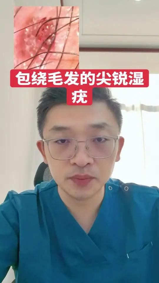 包绕毛发的尖锐湿疣 