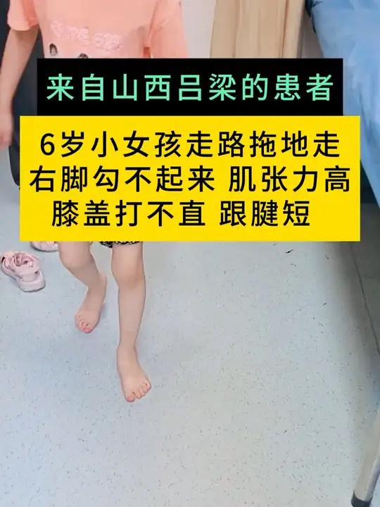 6岁小女孩走路拖地走右脚勾不起来 肌张力高 膝盖打不直 周围神经外科医生廉民学硬核健康科普