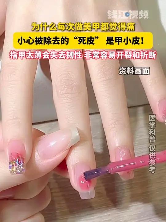 为什么每次做美甲都觉得痛,小心被除去的“死皮” 是甲小皮!指甲太薄会失去韧性 非常容易开裂