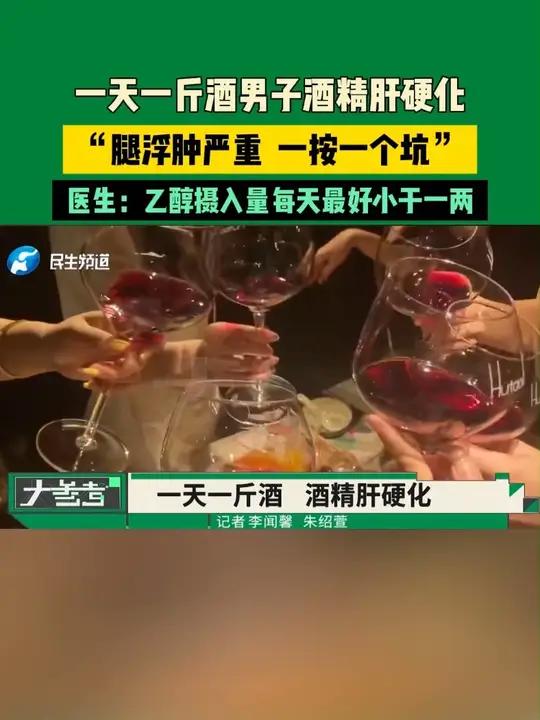 一天一斤酒男子酒精肝硬化,“腿浮肿严重,一按一个坑”,医生:乙醇摄入量每天最好小于一两