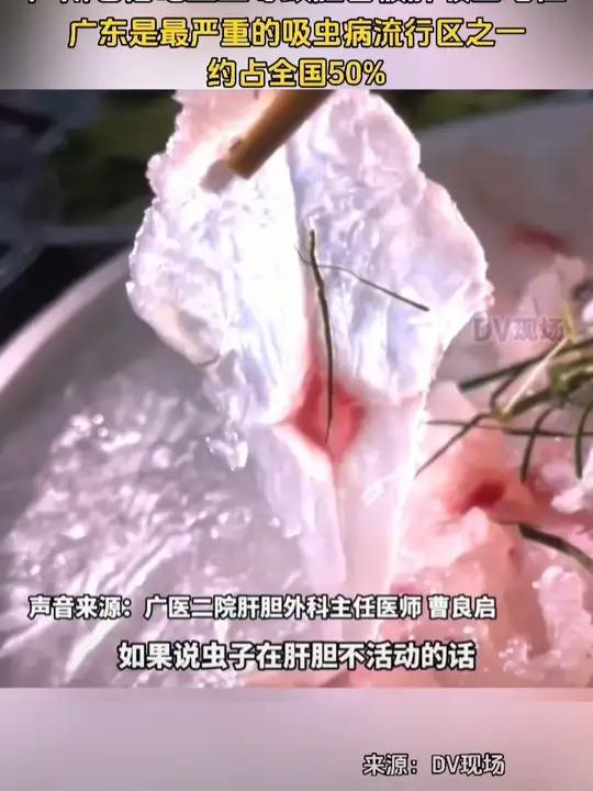 广州老伯吃鱼生致胆管被肝吸虫堵住。据统计,广东省是最严重的吸虫病流行区之一,约占全国50%