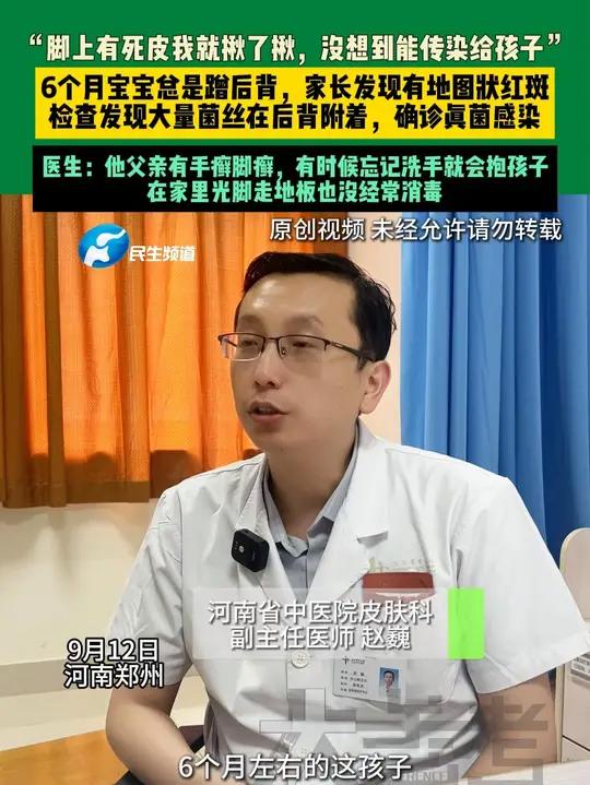 9月12日河南郑州“脚上有死皮我就揪了揪,没想到能传染给孩子”6个月宝宝总是蹭后背,家长发