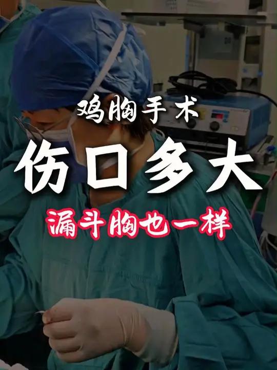 鸡胸矫正手术后伤口有多大?对身体的伤害大吗?来看一下。鸡胸医学科普 矫正 矫形板
