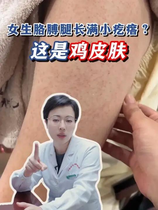 这是鸡皮肤