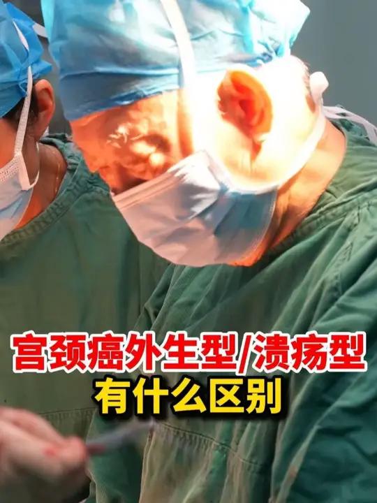 宫颈癌内生型和外生型有什么区别