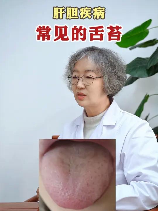 肝胆疾病常见的舌苔