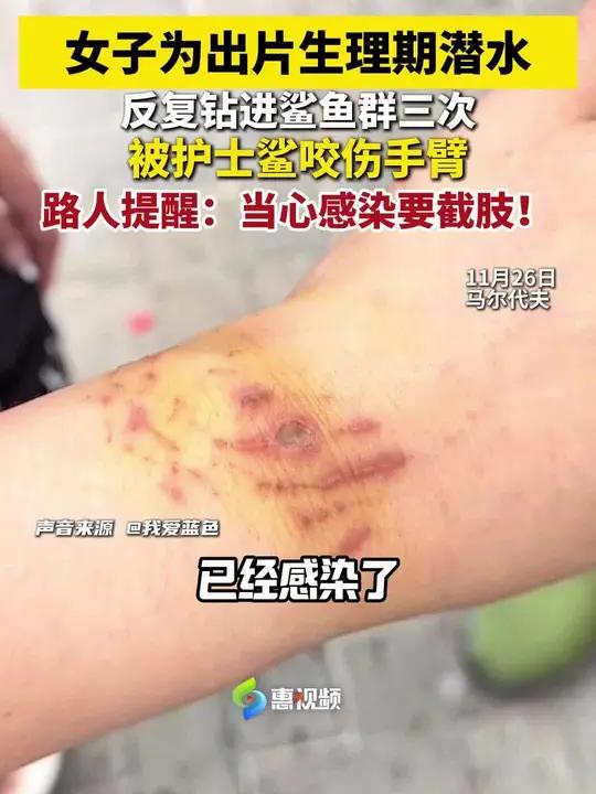 女子为出片生理期潜水,被鲨鱼咬伤手臂!路人提醒:当心感染要截肢!