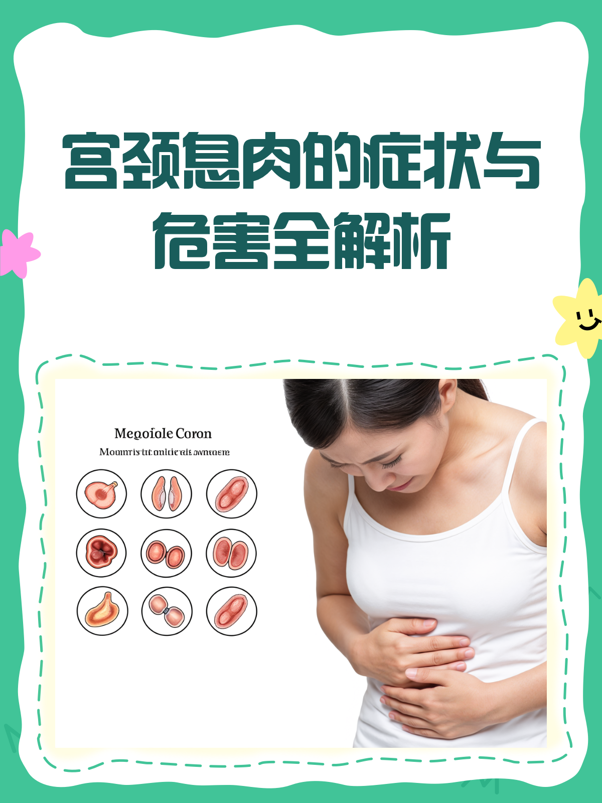 宫颈息肉,那些不可不知的症状与危害!