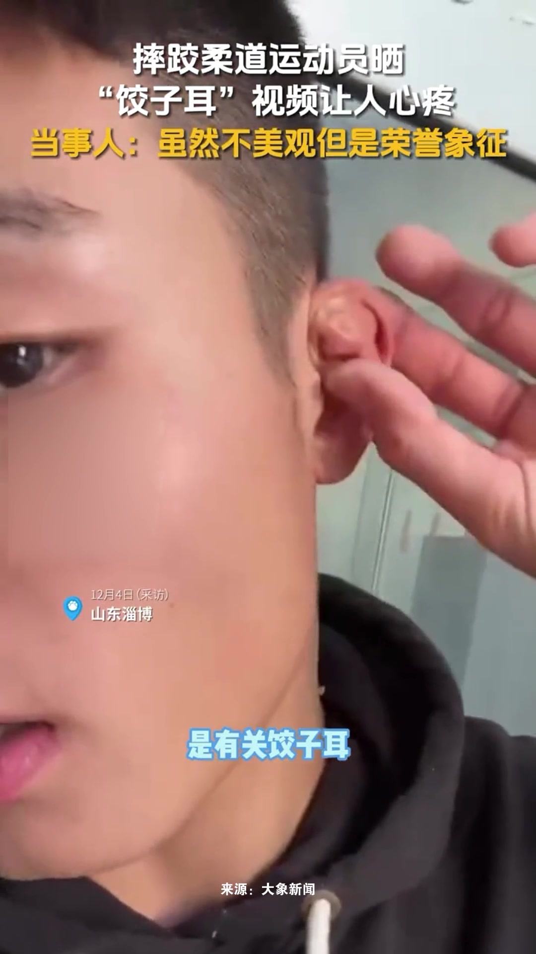 摔跤柔道运动员晒“饺子耳”视频让人心疼,当事人:虽然不美观但是荣誉象征