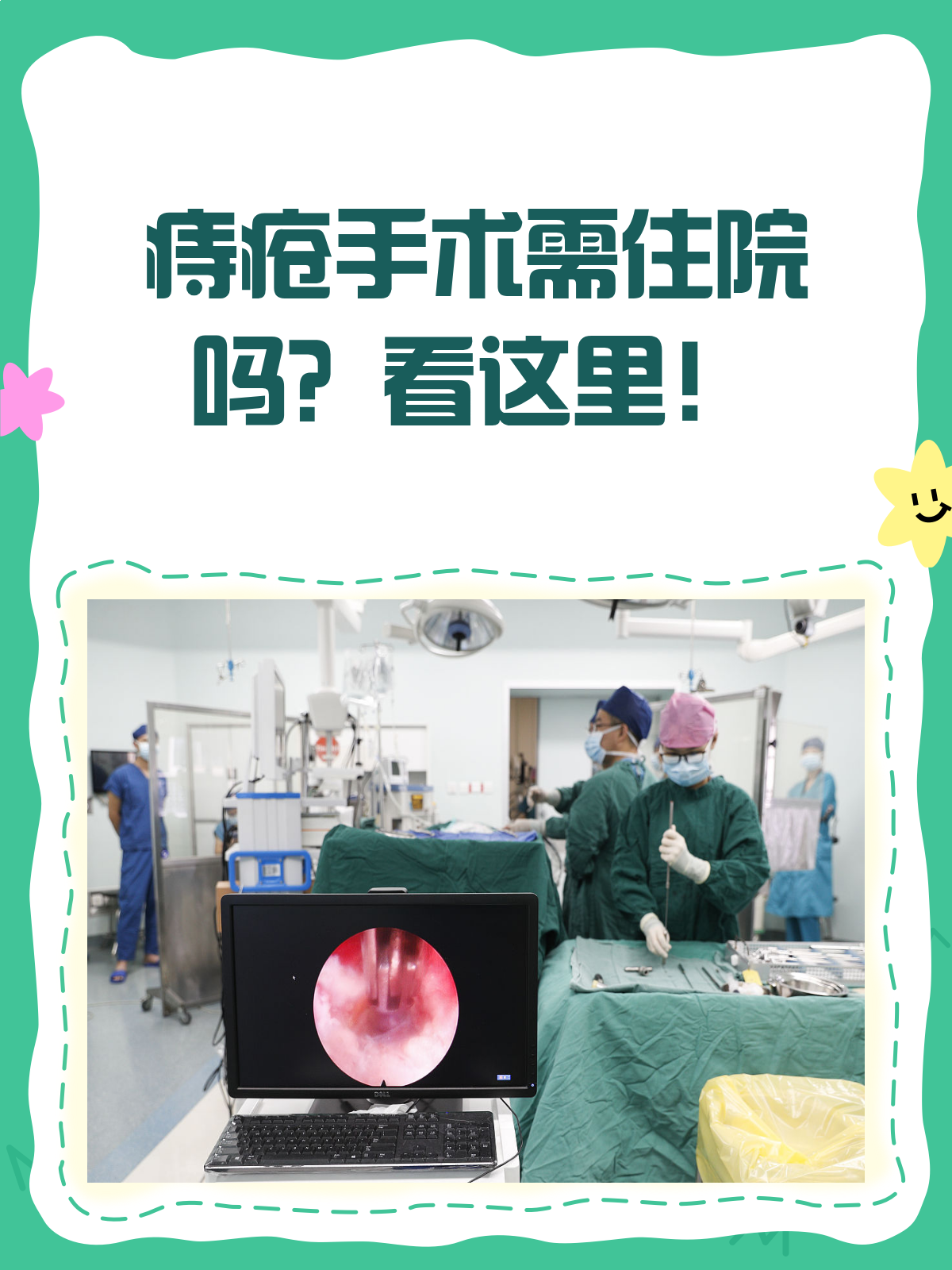 痔疮手术要不要住院?一文给你讲明白!