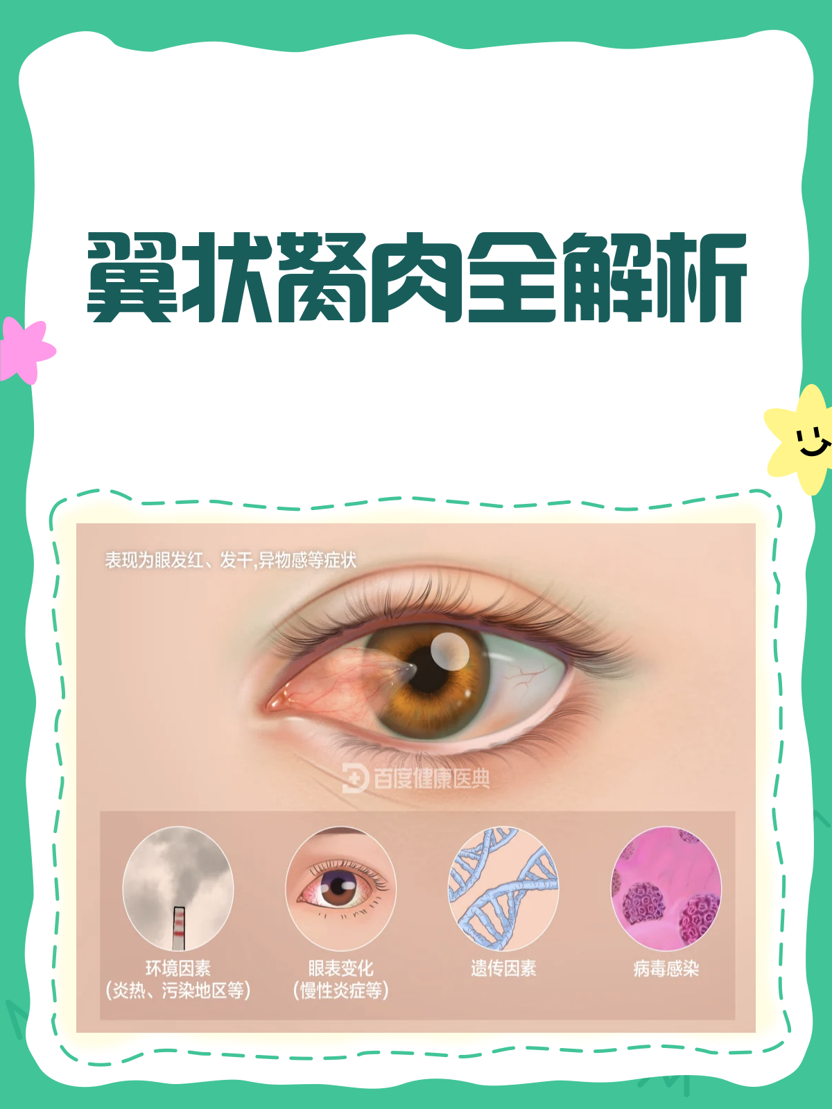 翼状胬肉来袭?了解它,才能战胜它!