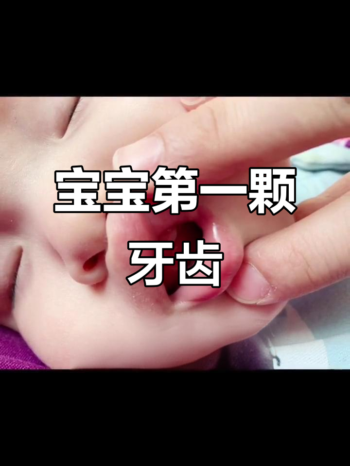 八个月宝宝先长一颗上牙,萌态十足