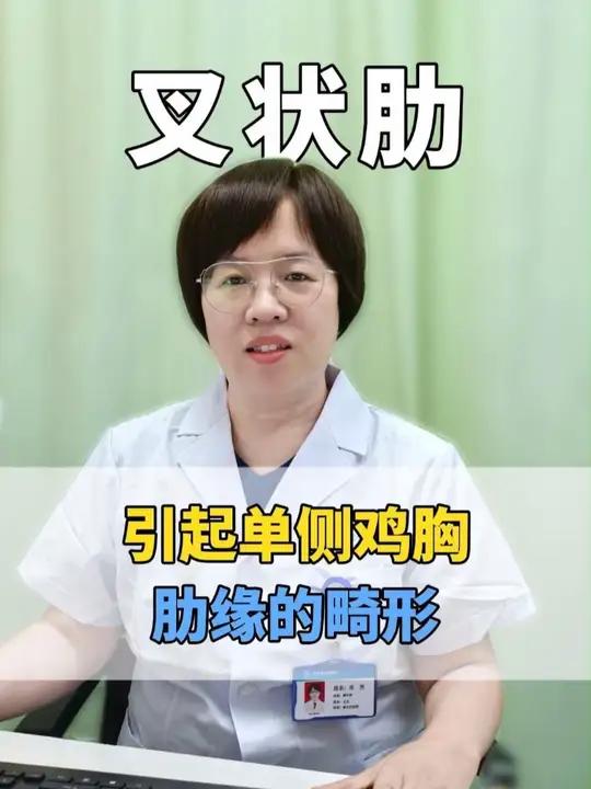 孩子叉状肋引起单侧鸡胸，孩子不是漏斗胸是胸壁畸形