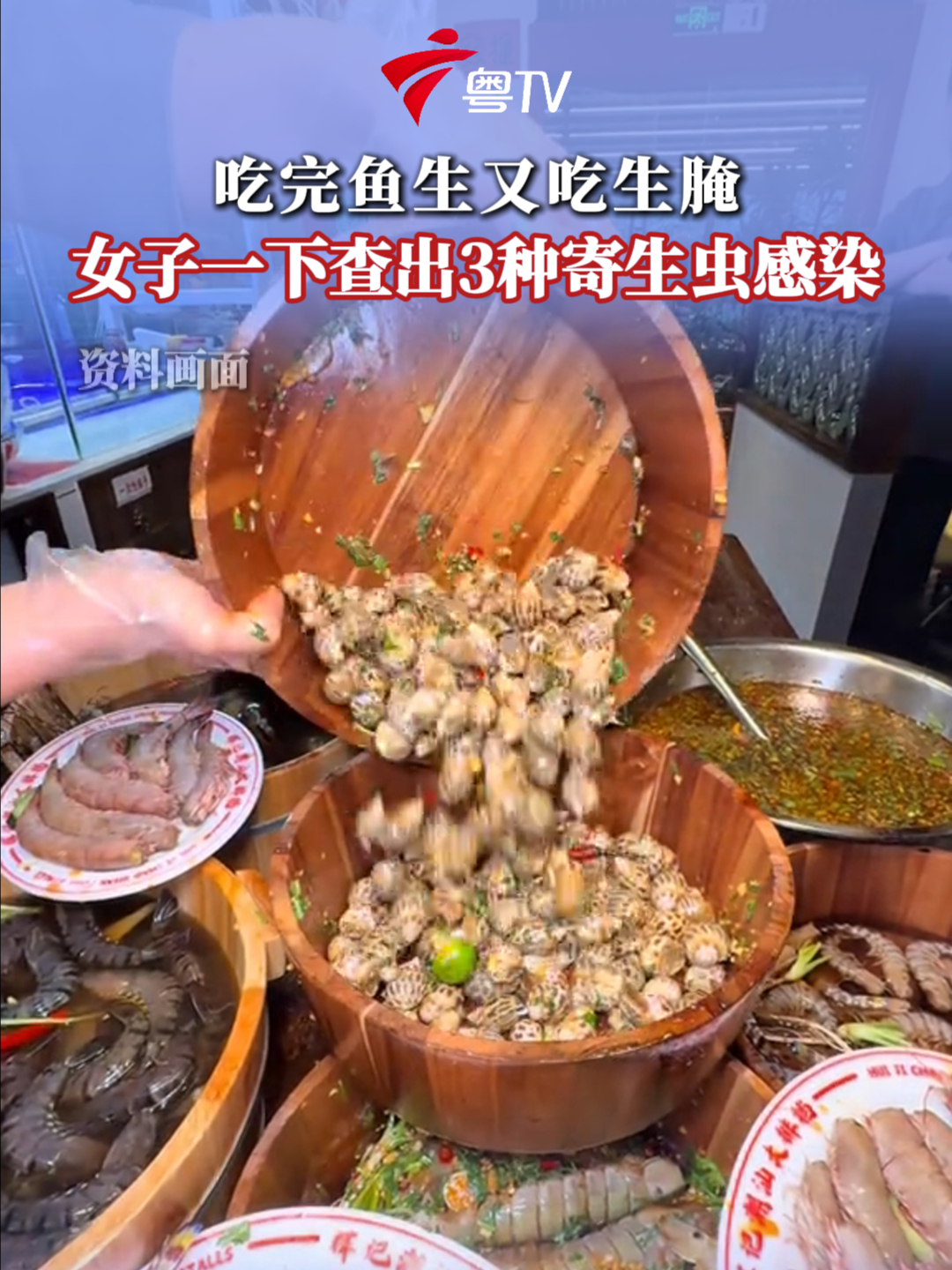吃完鱼生又吃生腌,女子一下查出3种寄生虫感染