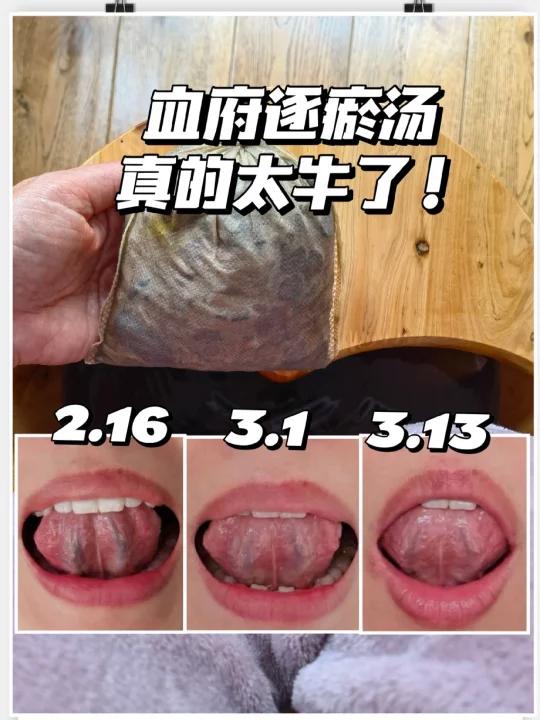 调理月经,种子循环VS血府逐瘀汤,真实反馈