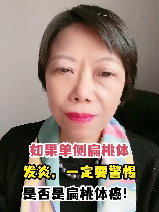如果单侧扁桃体发炎,一定要警惕是否是扁桃体癌!