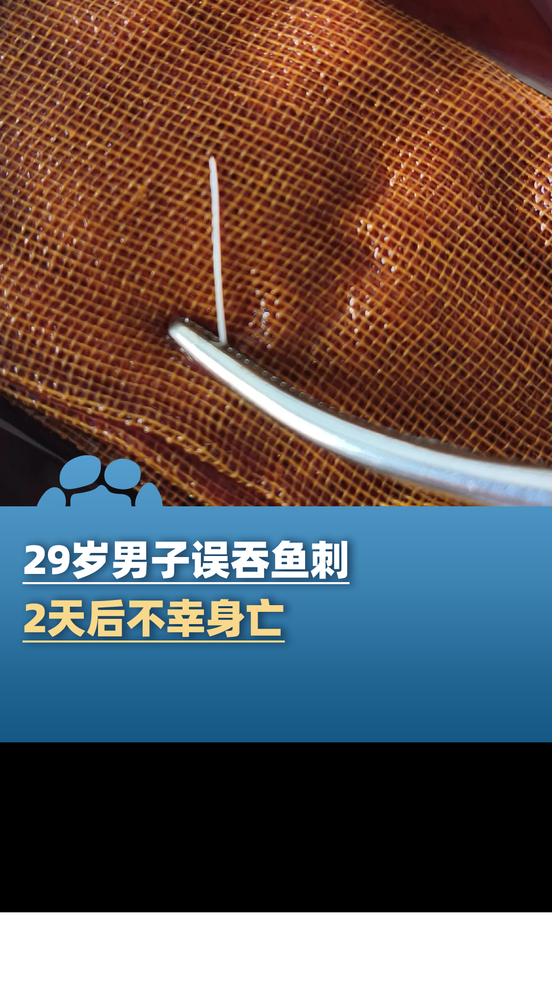 29岁男子误吞鱼刺两天后不幸身亡,医生:喝醋吞饭都是错的