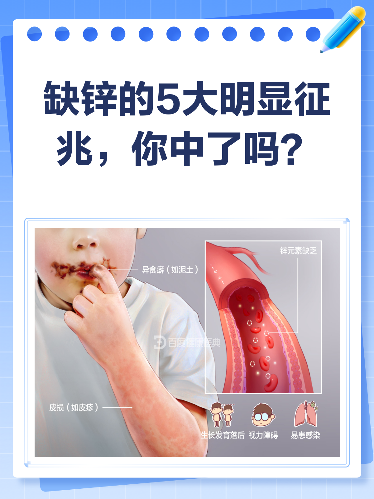 缺锌的5大明显征兆，你中招了吗？