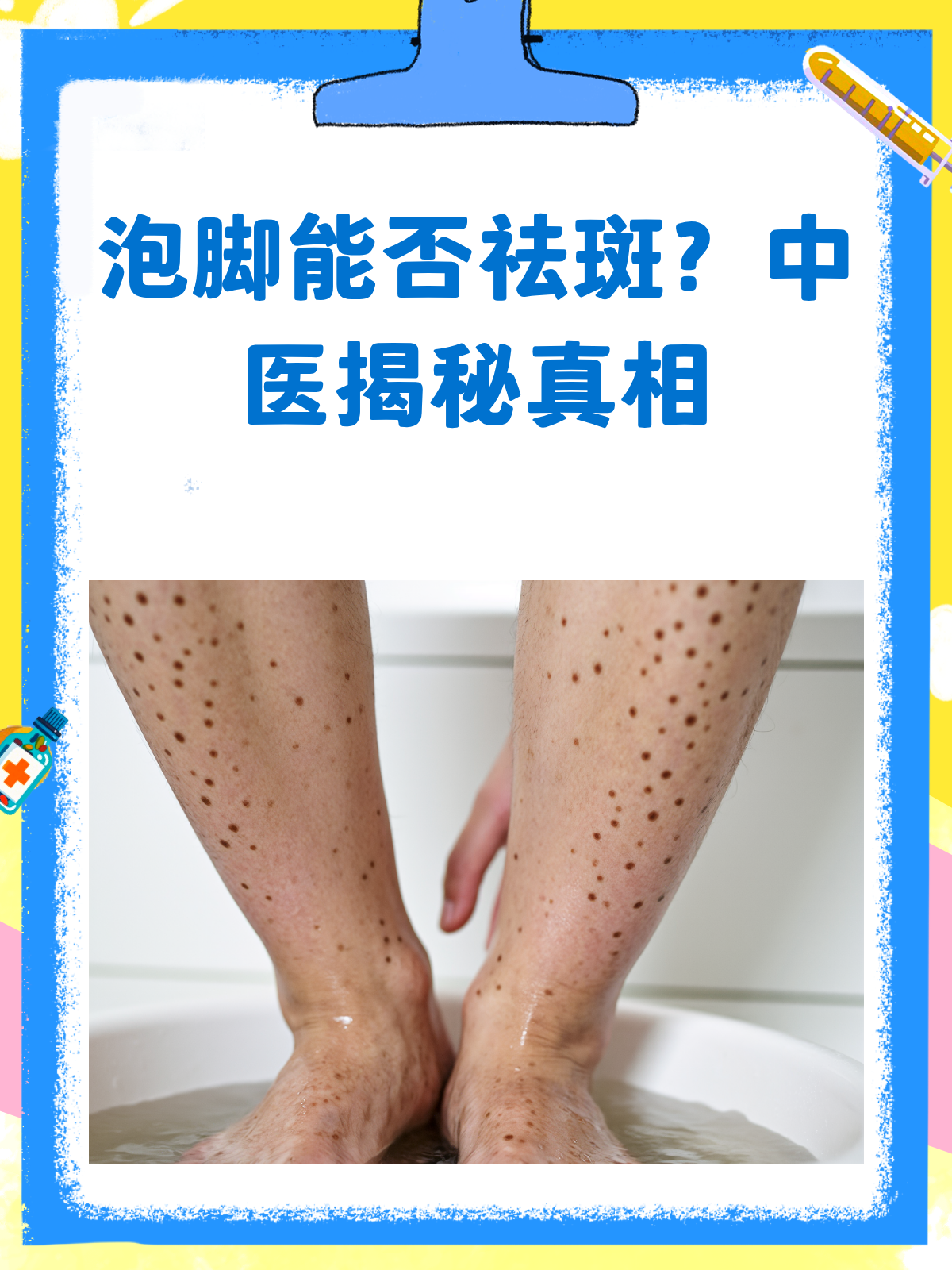 泡脚能祛斑?真相来了!