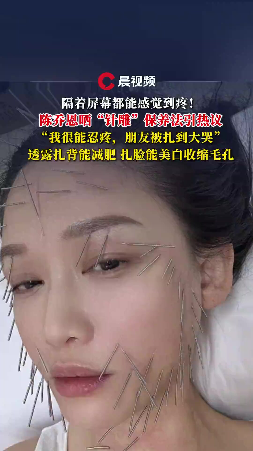 陈乔恩晒“针雕”保养法引热议!透露扎背能减肥,扎脸能美白收缩毛孔