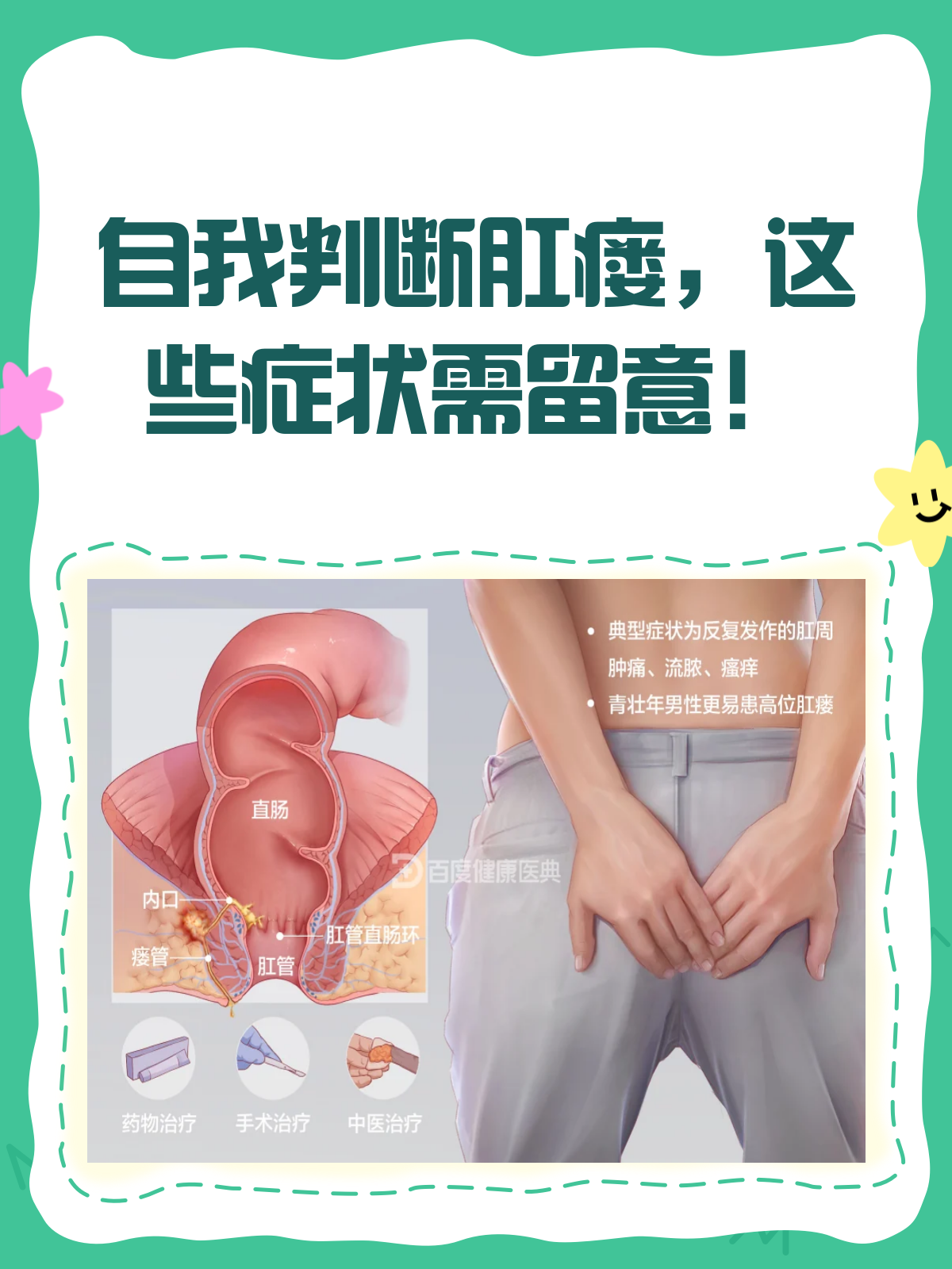 肛门不适?教你几招自判肛瘘!