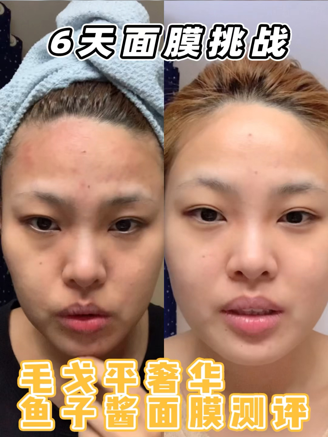 毛戈平奢华鱼子酱面膜深度测评