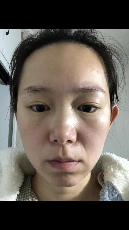 奔四坚持面部肌肉训练2年｜教程篇