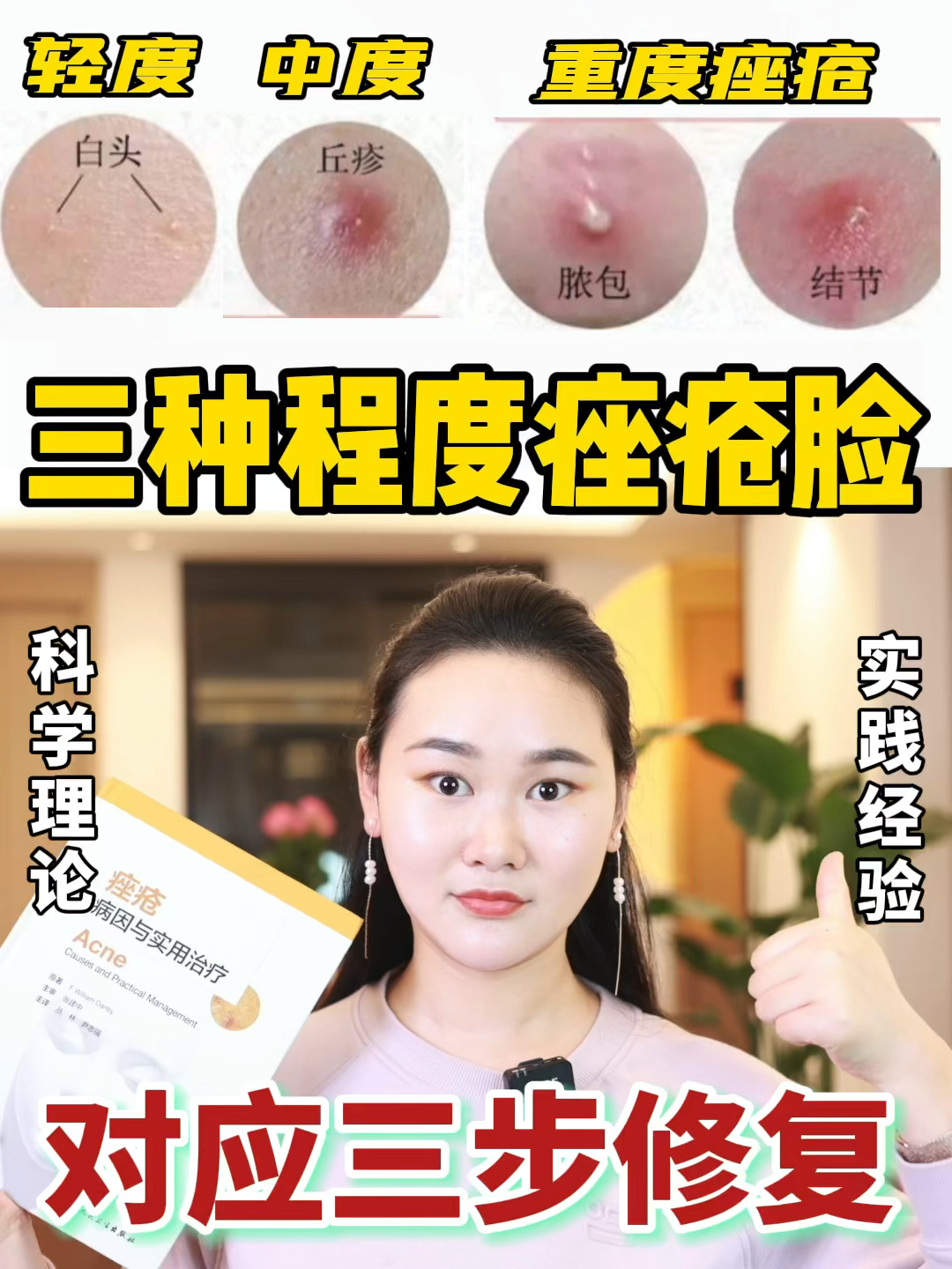 如何治疗痘痘痤疮十年痤疮脸泪经验分享