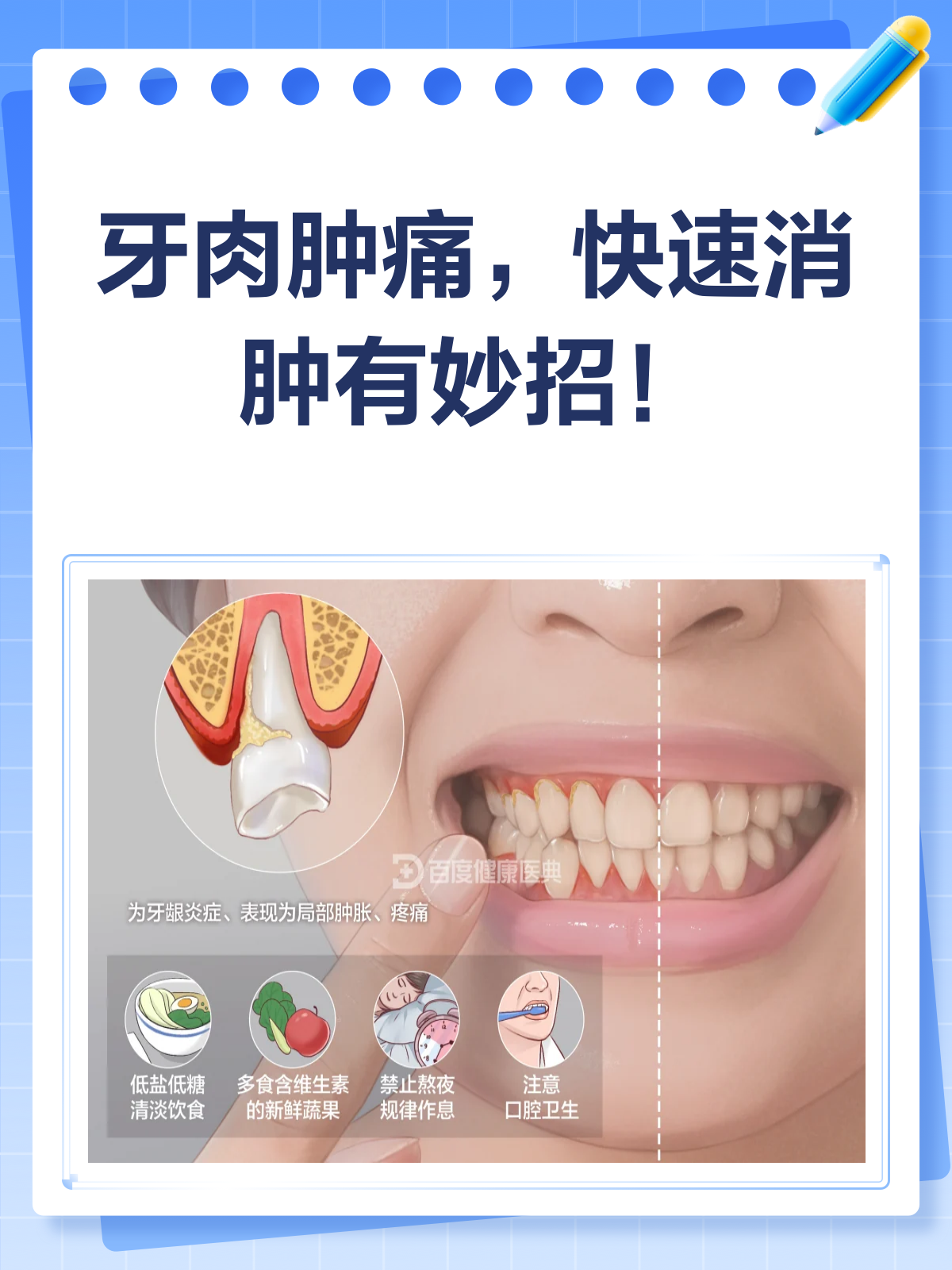 牙肉肿痛太难受?快速消肿就看这一篇!